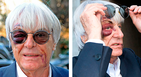 Bernie Ecclestone